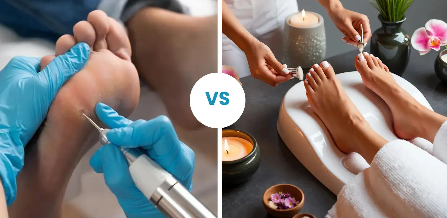 Rozdiel medzi medicinálnou a klasickou pedikúrou
