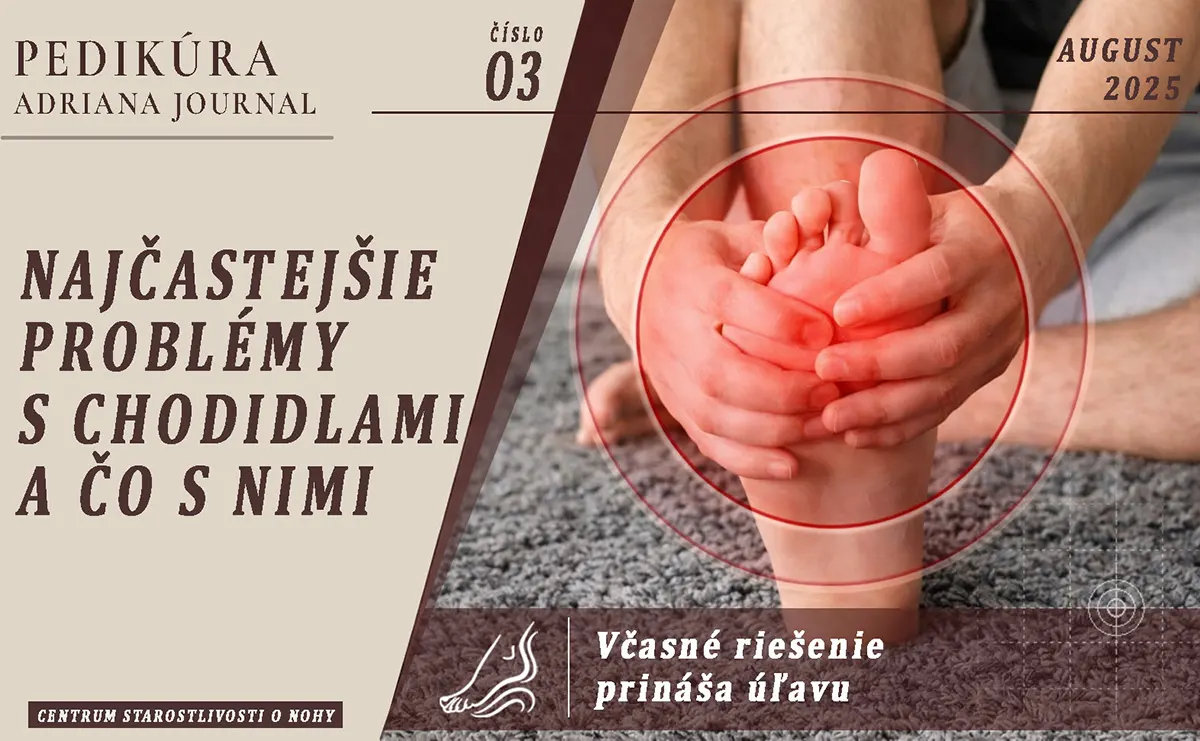 Najčastejšie problémy s chodidlami a čo s nimi