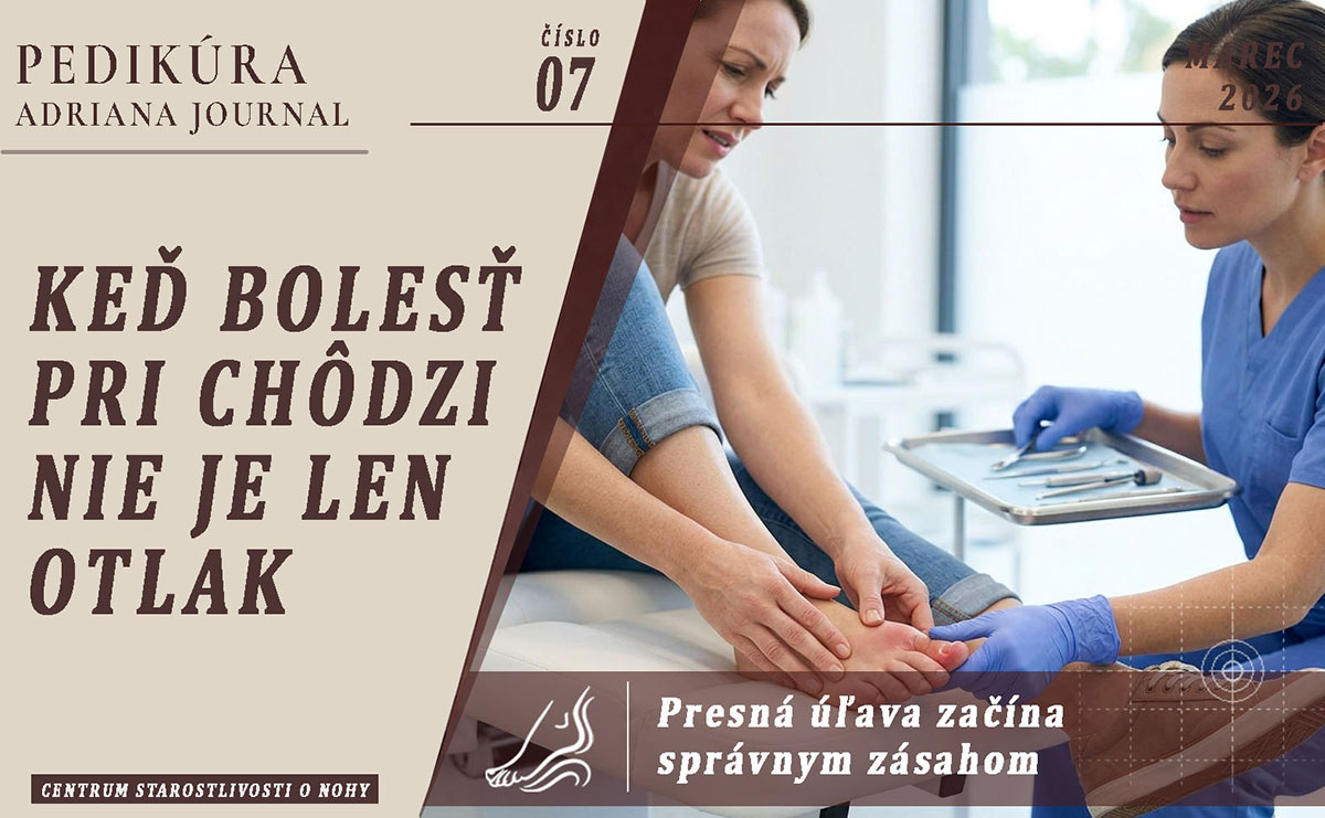 Keď bolesť pri chôdzi nie je „len otlak“
