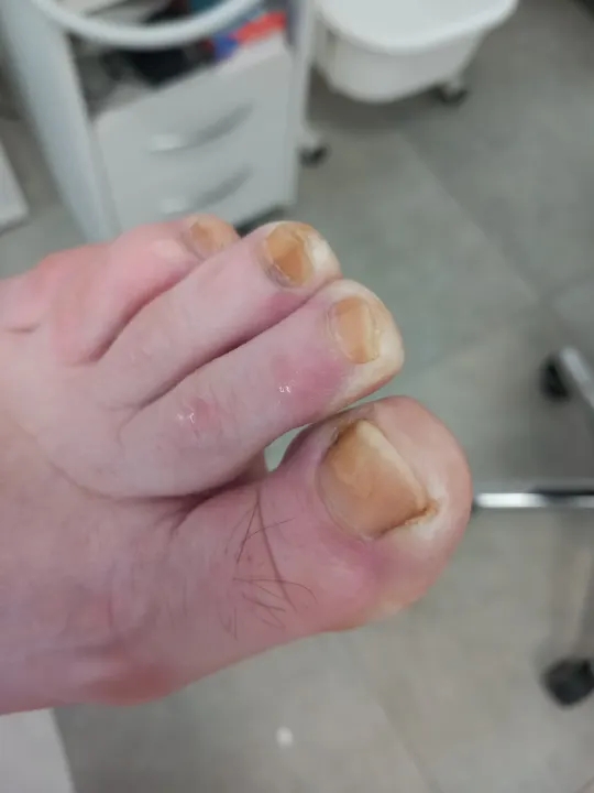Keď dlhé nechty začnú tlačiť na končeky prstov