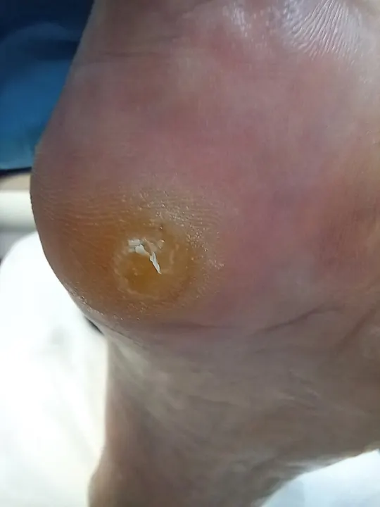 Tri malé miesta, ktoré vedia pokaziť každý krok