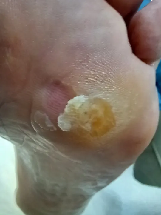 Tri malé miesta, ktoré vedia pokaziť každý krok