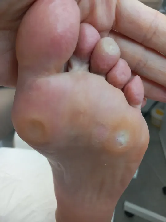 Tri malé miesta, ktoré vedia pokaziť každý krok