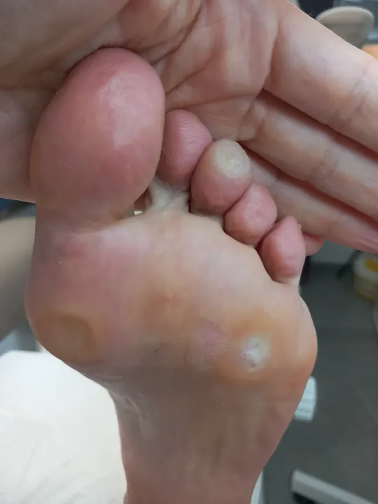 Tri malé miesta, ktoré vedia pokaziť každý krok