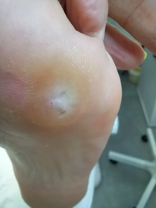 Tri malé miesta, ktoré vedia pokaziť každý krok