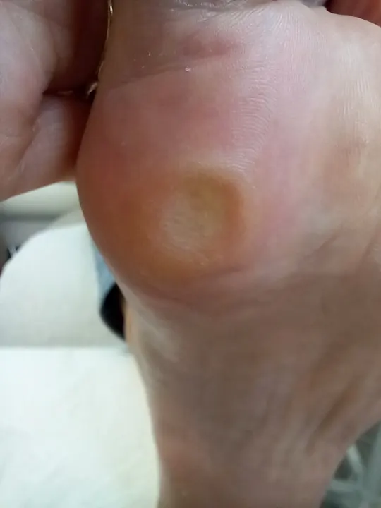 Tri malé miesta, ktoré vedia pokaziť každý krok
