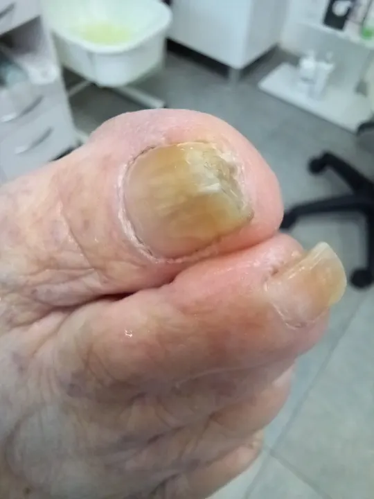 Žltohnedý necht pripravený na zdravší rast