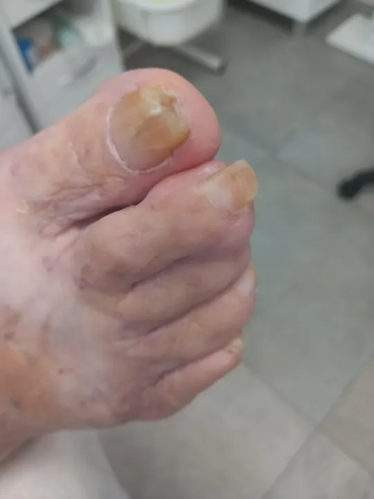 Žltohnedý necht pripravený na zdravší rast