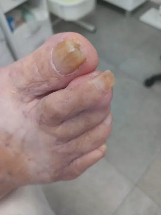 Žltohnedý necht pripravený na zdravší rast