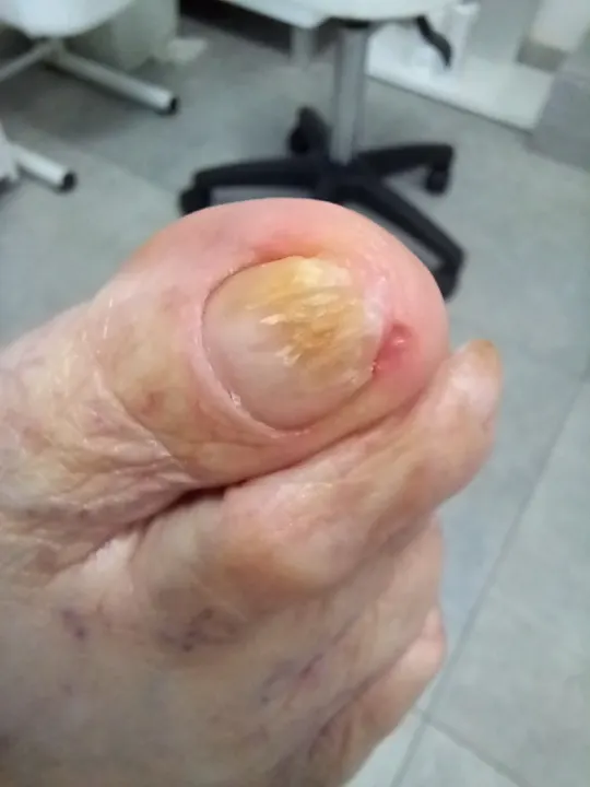 Žltohnedý necht pripravený na zdravší rast