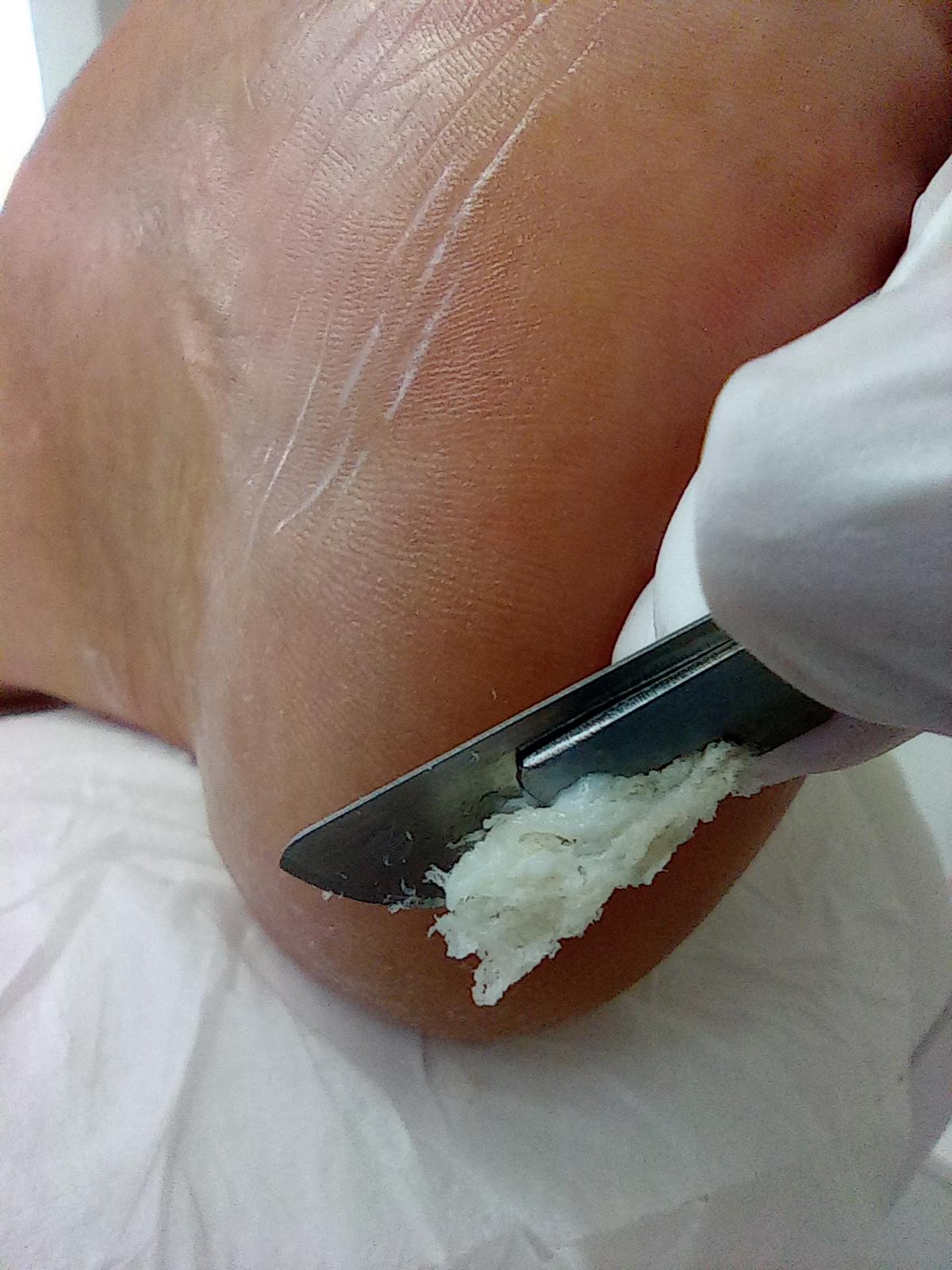 Pedikúra mokrá/kombinovaná